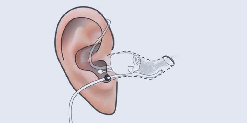 REM probe tube placement