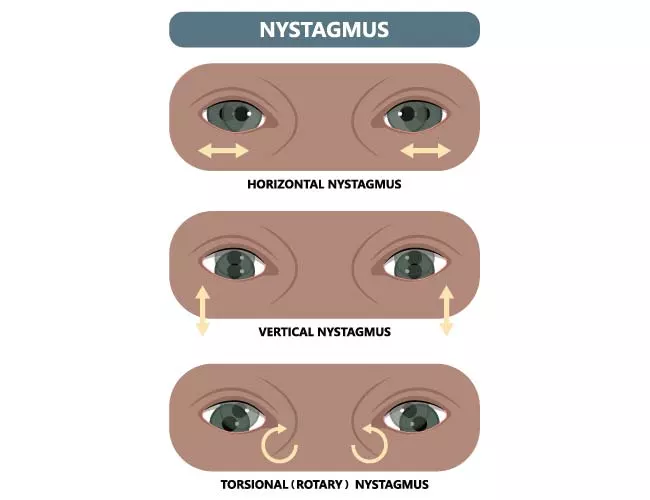 Nystagmus refers to repetitive uncontrolled eye movements